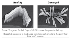 Healthy and damaged hair cells