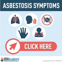 Asbestosis symptoms infographic