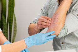 Gloved caregiver looking at patients arm