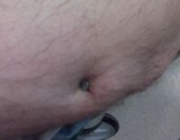 Worker had nail gun misfire directly into the belly button